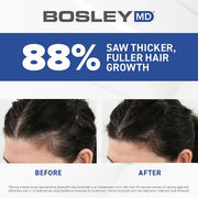 BosleyMD Women's Hair Regrowth 60-Day Power Duo (2 pk.)